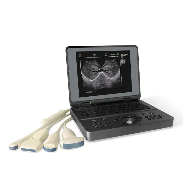 Full Digital Veterinary Ultrasound lmaging