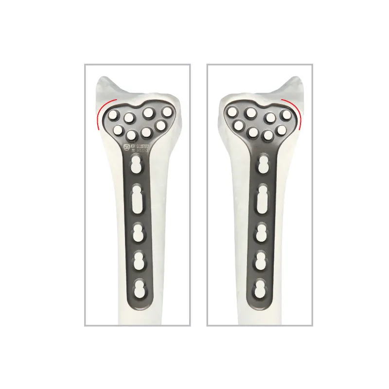 Multi-Axial Distal Radial Volar Locking Plate