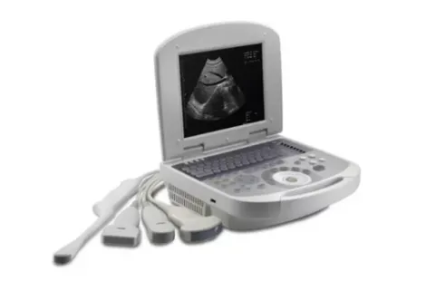 What Is a Portable Ultrasound Machine?