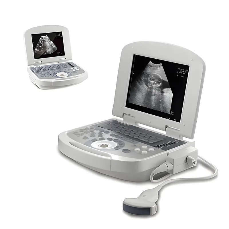 Portable Ultrasonic Diagnostic Devices