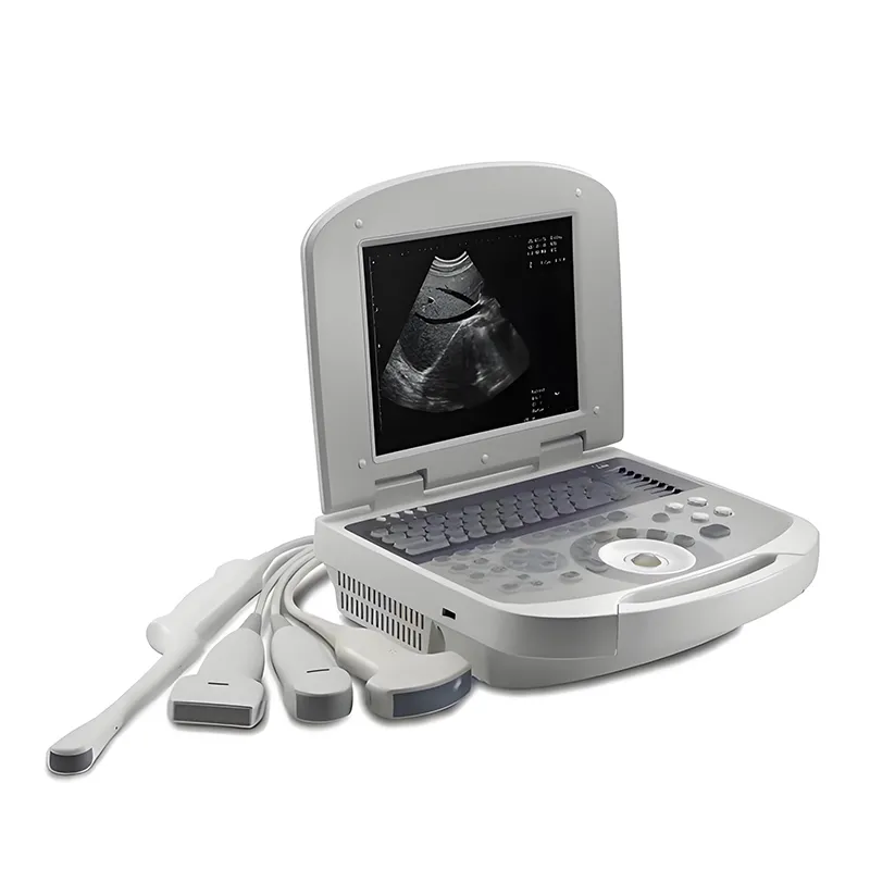 Portable Ultrasonic Diagnostic Devices