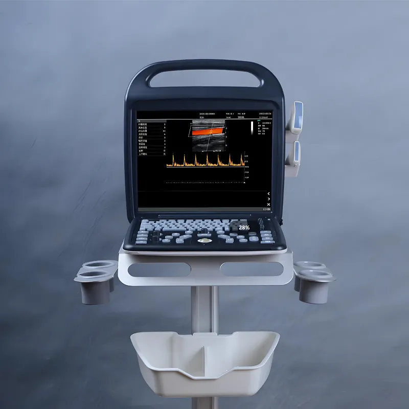 Portable Ultrasonic Diagnostic Devices