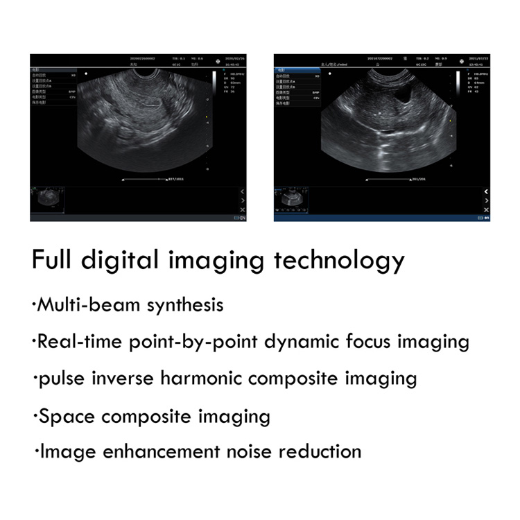 Portable Ultrasonic Diagnostic Devices