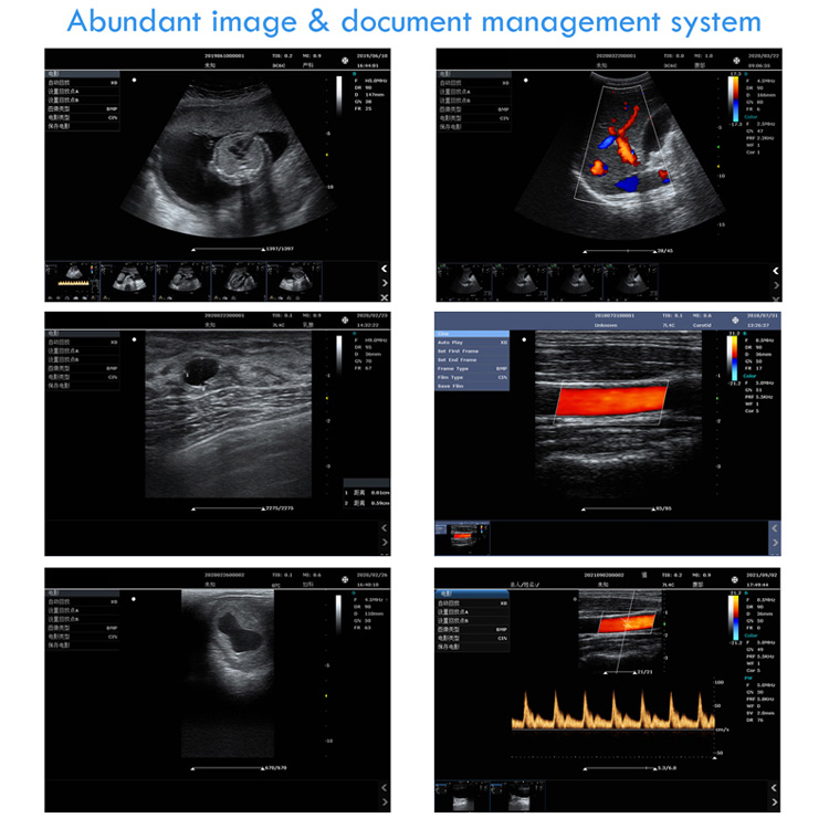 Portable Ultrasonic Diagnostic Devices