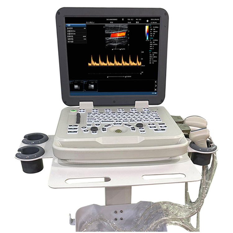 Portable Ultrasonic Diagnostic Devices