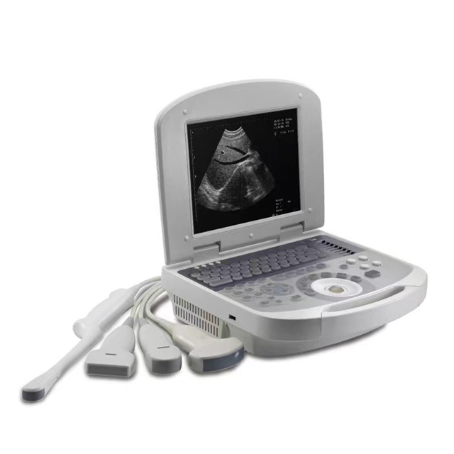 Portable Ultrasonic Diagnostic Devices