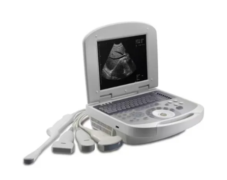 Portable Ultrasound Machines