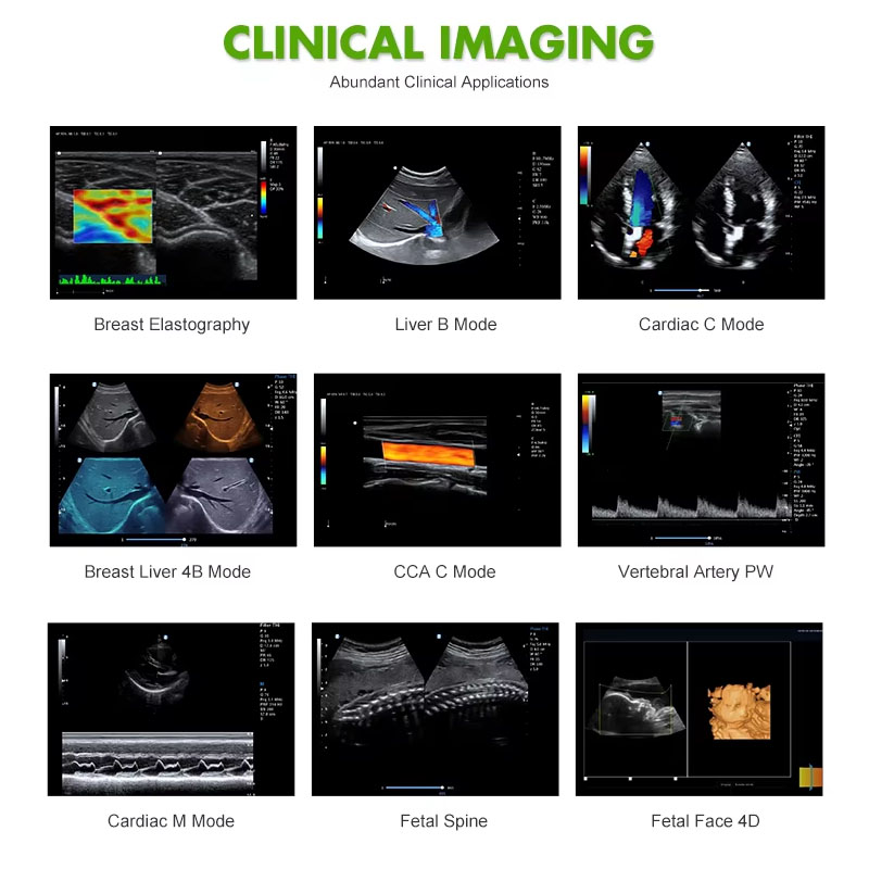 Portable Ultrasonic Diagnostic Devices